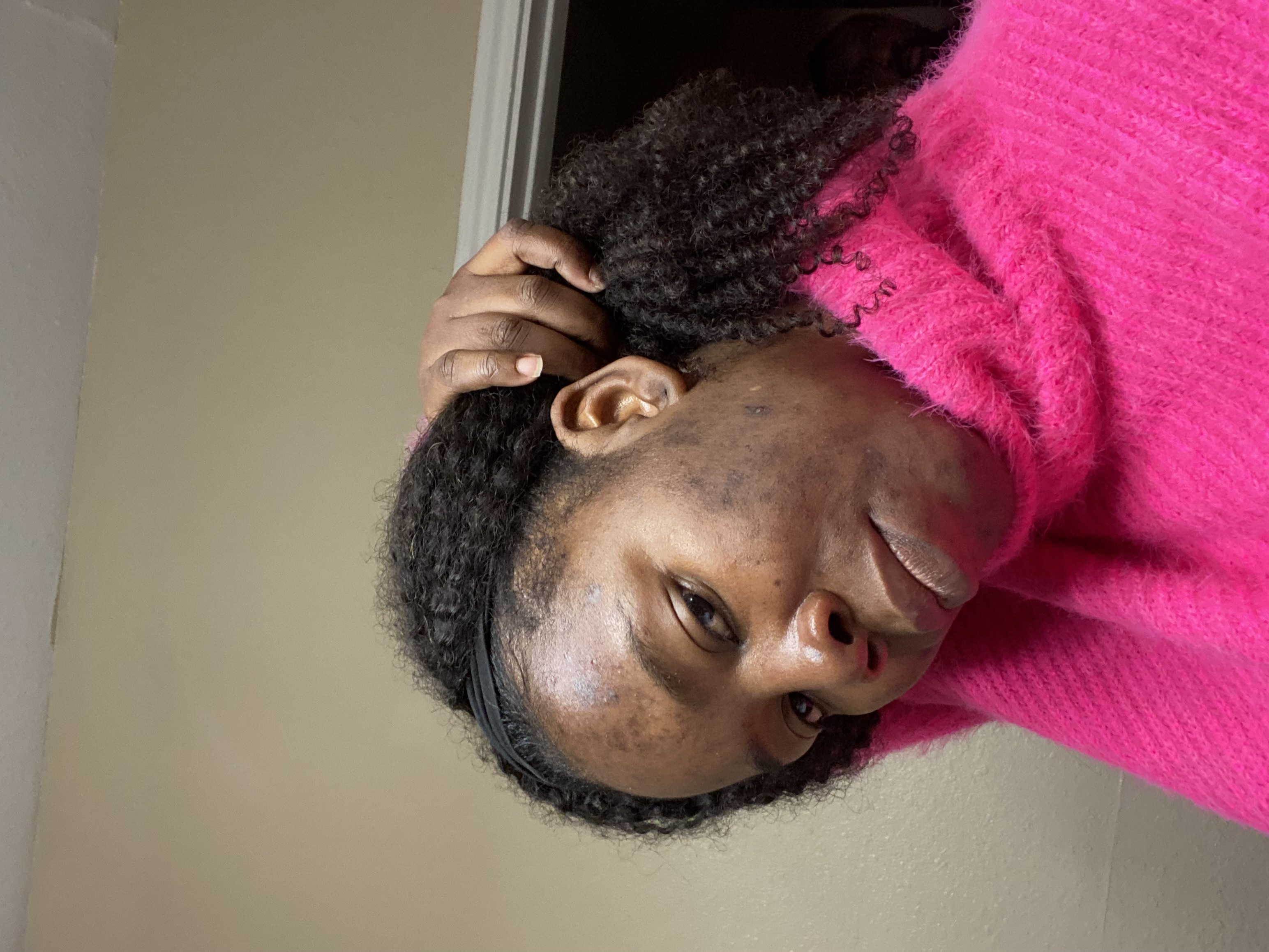 Nancy — before Our Moringa Radiance Ritual